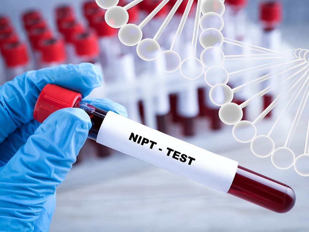 Niet-invasieve prenatale test