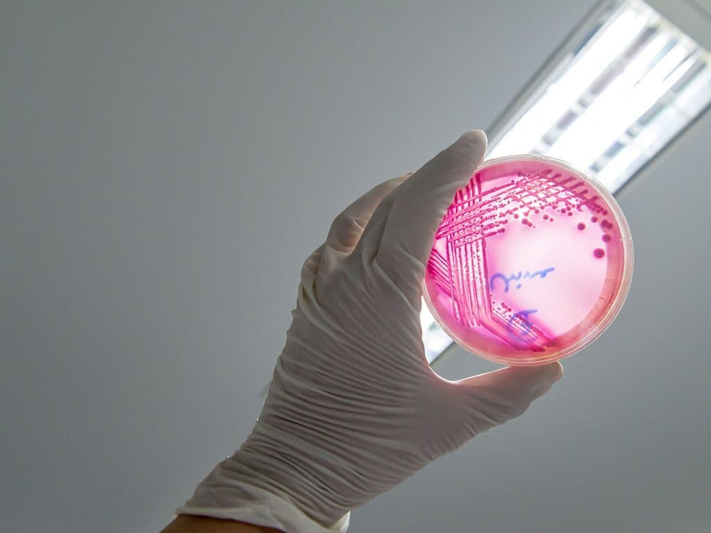 Hoe heet de bacterie die eind mei 2011 tientallen doden maakte en ervoor zorgde dat de komkommerverkoop kelderde?