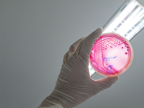 EHEC-bacterie
